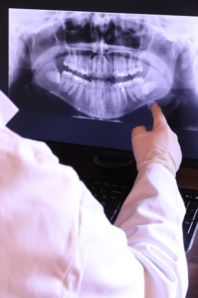 Best Emergency Root Canal Therapy in Larch Y, WA