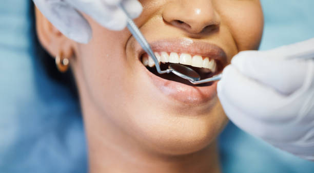Best Emergency Wisdom Tooth Extraction in Larch Y, WA