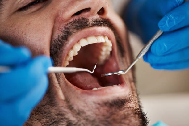 Best Emergency Care for Gum Disease in Larch Y, WA