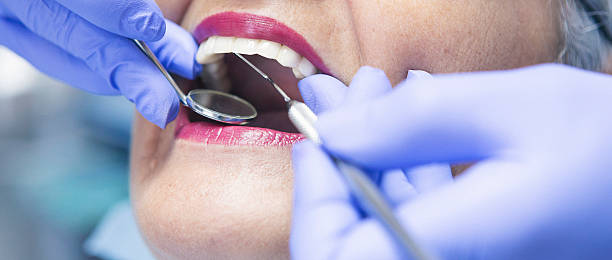Best Knocked-Out Tooth (Avulsed Tooth) Treatment in Larch Y, WA